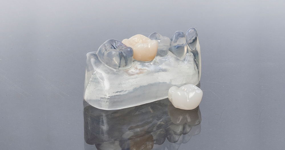 mlx-zirconia-glass-model