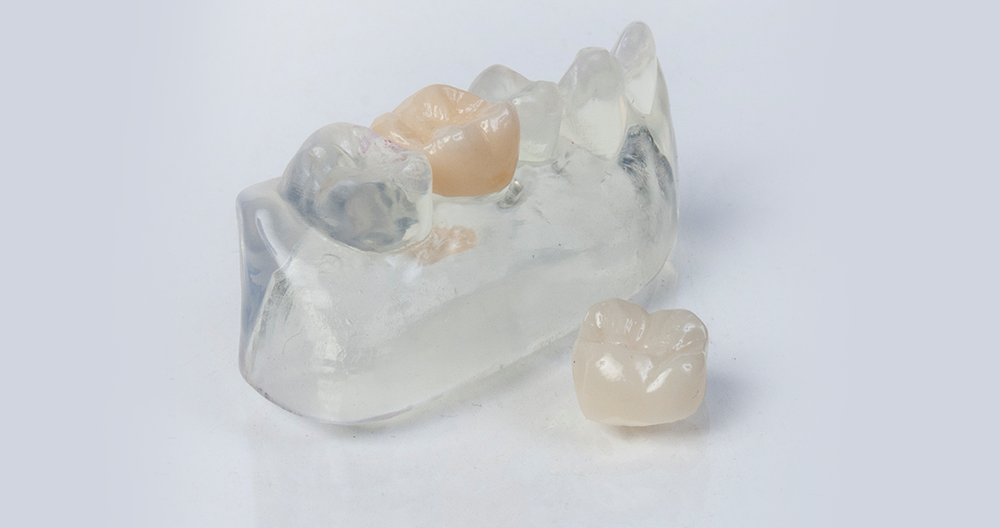 mlx-zirconia-light-bg