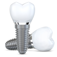 dental implants